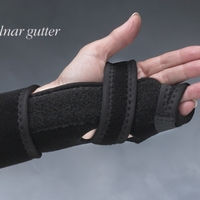 Hely Weber TKO The Knuckle Orthosis - North Coast Medical